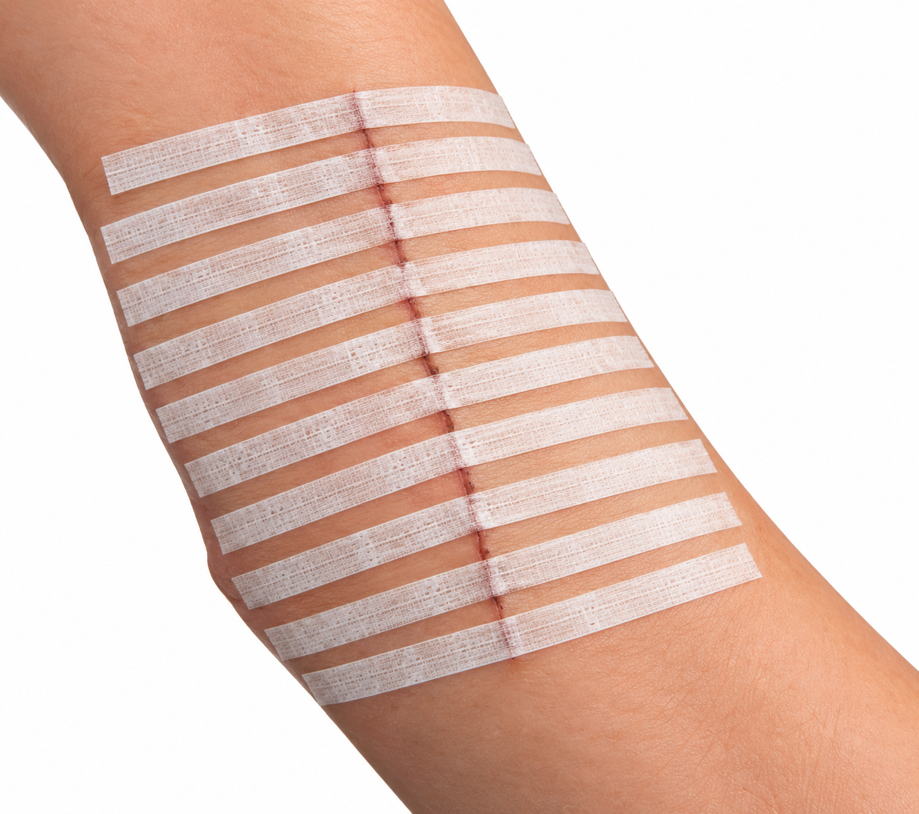 Sterile Wound Closure Strips, 1/4" x 4"- (Steri-Strip Equivalent)- Pack of #10